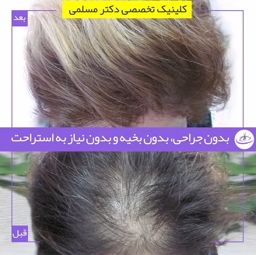 نمونهکار دکتر مینا مسلمی