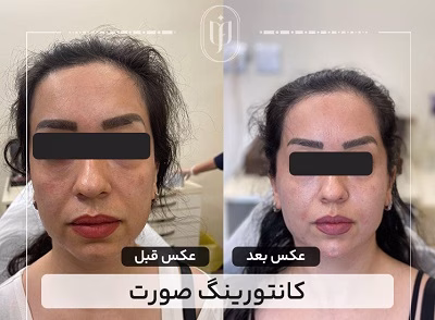 نمونهکار دکتر مریم فروغی