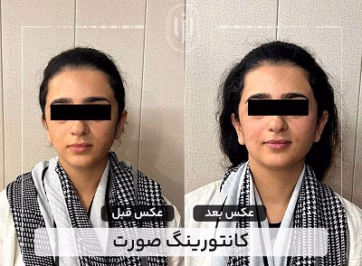 نمونهکار دکتر مریم فروغی