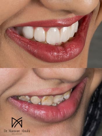 نمونهکار دکتر منصوره ابطحی