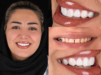 نمونهکار دکتر منصوره ابطحی