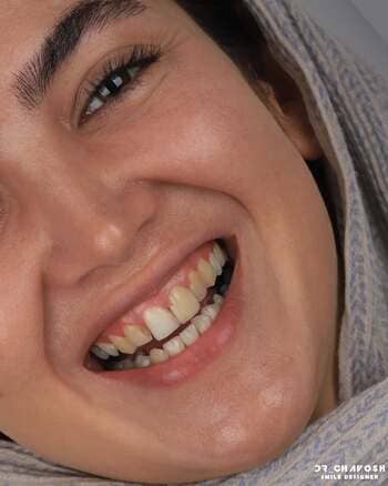 نمونهکار دکتر مهدی چاوش