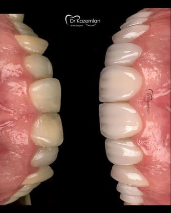 نمونهکار دکتر مهرداد کاظمیان