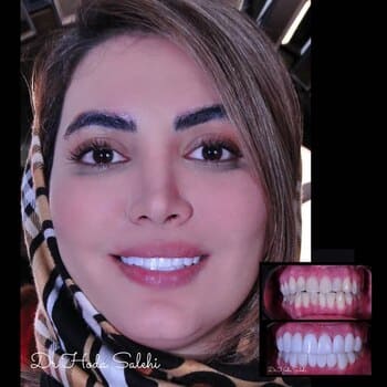 نمونهکار دکتر هدی صالحی