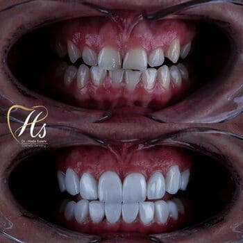 نمونهکار دکتر هدی صالحی