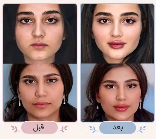 نمونهکار دکتر رویا تقی پور