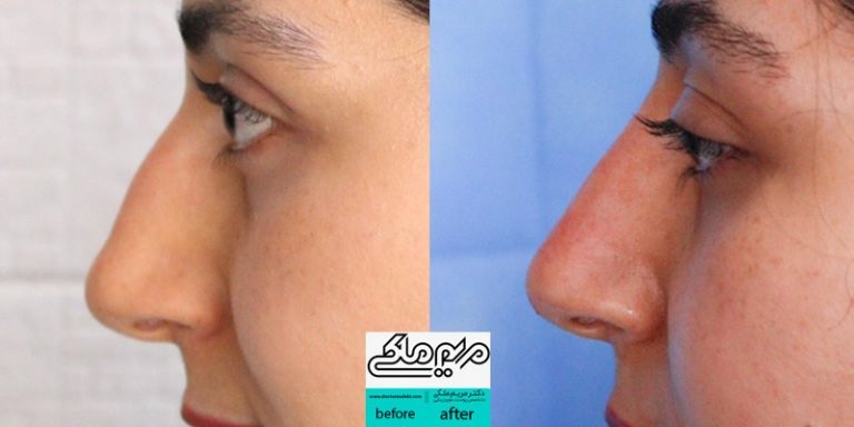 نمونهکار دکتر مریم ملکی