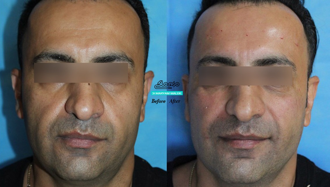 نمونهکار دکتر مریم ملکی