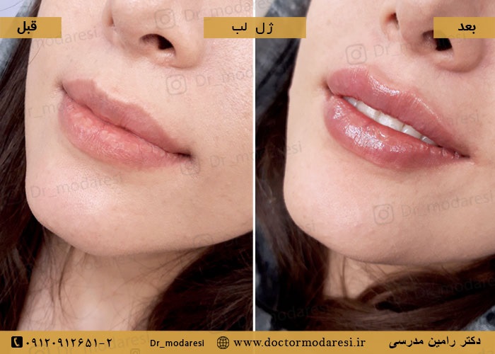 نمونهکار دکتر رامین مدرسی