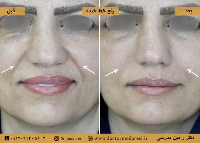 نمونهکار دکتر رامین مدرسی
