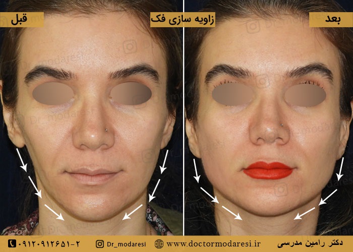 نمونهکار دکتر رامین مدرسی