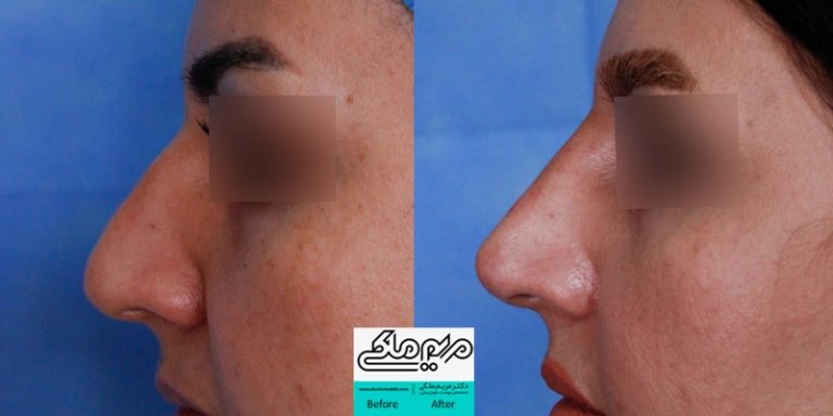 نمونهکار دکتر مریم ملکی
