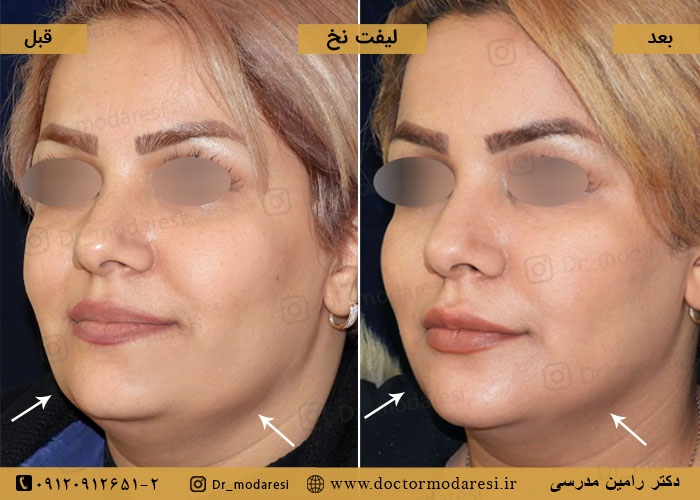 نمونهکار دکتر رامین مدرسی