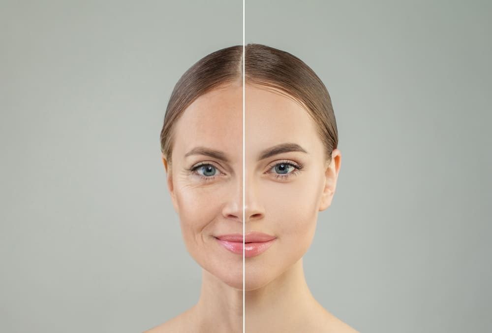 پیج زاویه سازی صورت شیراز