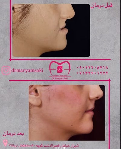 نمونهکار دکتر مریم صاکی