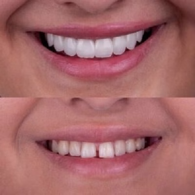 نمونهکار دکتر مریم فیروزمندی