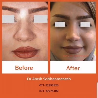 نمونهکار دکتر آرش سبحان منش