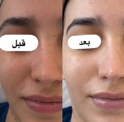 نمونهکار آزی اسکین کر